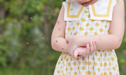 Little girl has skin rash allergy itching and scratching on her arm with mosquitoes bite